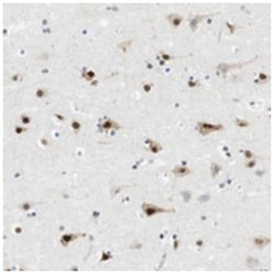 RNF38, Rabbit, Polyclonal Antibody, Abnova 100&mu;L; Unlabeled:Antibodies,