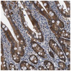 TMEM45B, Rabbit, Polyclonal Antibody, Abnova 100 &mu;L | Buy Online | Abnova | Fisher Scientific