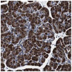FAR2, Rabbit, Polyclonal Antibody, Abnova 100 &mu;L | Buy Online | Abnova Corporation | Fisher Scientific