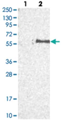 FAR2, Rabbit, Polyclonal Antibody, Abnova 100 &mu;L | Buy Online | Abnova Corporation | Fisher Scientific