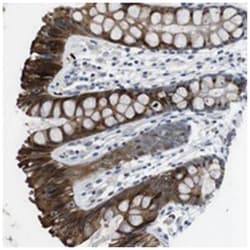 WSCD1, Rabbit, Polyclonal Antibody, Abnova 100&mu;L; Unlabeled:Antibodies,