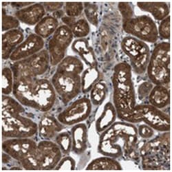 TMEM132C Rabbit anti-Human, Polyclonal Antibody, Abnova 100&mu;L; Unlabeled:Antibodies,
