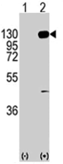 FGFR1 Rabbit anti-Human, Polyclonal Antibody, Abnova 400 &mu;L | Buy Online | Abnova Corporation | Fisher Scientific