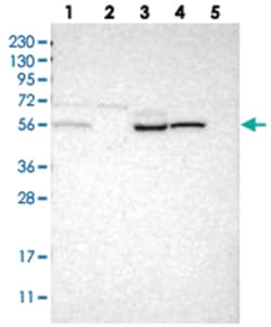 PIEZO2, Rabbit, Polyclonal Antibody, Abnova 100 &mu;L | Buy Online | Abnova Corporation | Fisher Scientific