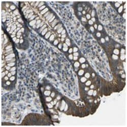 PIEZO2, Rabbit, Polyclonal Antibody, Abnova 100 &mu;L | Buy Online | Abnova Corporation | Fisher Scientific