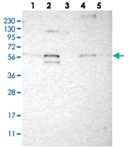C1orf27, Rabbit, Polyclonal Antibody, Abnova 100 &mu;L | Buy Online | Abnova Corporation | Fisher Scientific