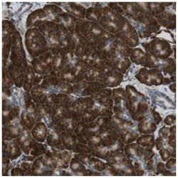 C1orf27, Rabbit, Polyclonal Antibody, Abnova 100 &mu;L | Buy Online | Abnova Corporation | Fisher Scientific