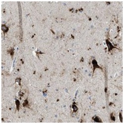 TSPAN3, Rabbit, Polyclonal Antibody, Abnova 100&mu;L; Unlabeled:Antibodies,