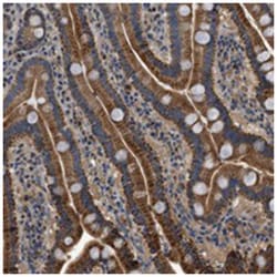 KCNK1, Rabbit, Polyclonal Antibody, Abnova 100&mu;L; Unlabeled:Antibodies,