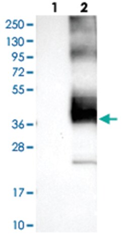 KCNK1, Rabbit, Polyclonal Antibody, Abnova 100&mu;L; Unlabeled:Antibodies,