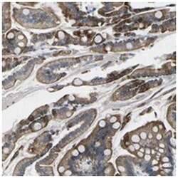 TM6SF1, Rabbit, Polyclonal Antibody, Abnova 100 &mu;L | Buy Online | Abnova Corporation | Fisher Scientific