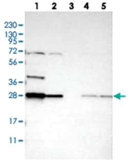 BPGM Rabbit anti-Human, Mouse, Rat, Polyclonal Antibody, Abnova 100&mu;L;