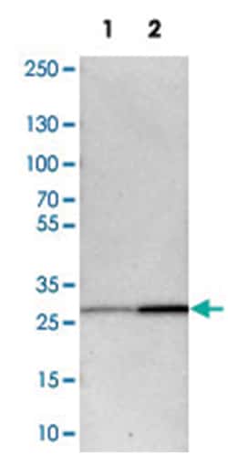 BPGM Rabbit anti-Human, Mouse, Rat, Polyclonal Antibody, Abnova 100&mu;L;