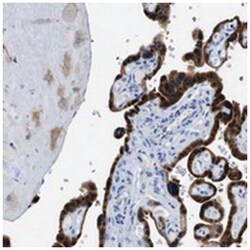 BPGM Rabbit anti-Human, Mouse, Rat, Polyclonal Antibody, Abnova 100&mu;L;