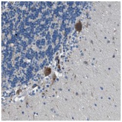 ABCG5, Rabbit, Polyclonal Antibody, Abnova 100&mu;L; Unlabeled:Antibodies,