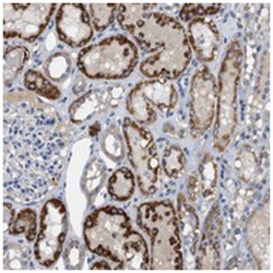 ERN2 Rabbit anti-Human, Polyclonal Antibody, Abnova 100 &mu;L | Buy Online | Abnova Corporation | Fisher Scientific