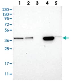 SLC35E1, Rabbit, Polyclonal Antibody, Abnova 100&mu;L; Unlabeled:Antibodies,
