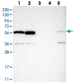 ATF7IP Rabbit anti-Human, Polyclonal Antibody, Abnova 100 &mu;L | Buy Online | Abnova Corporation | Fisher Scientific