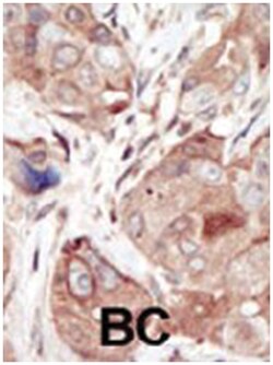 KDR Rabbit anti-Human, Polyclonal Antibody, Abnova 400 &mu;L | Buy Online | Abnova Corporation | Fisher Scientific