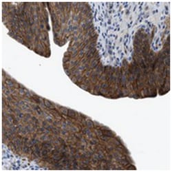ZDHHC24, Rabbit, Polyclonal Antibody, Abnova 100 &mu;L | Buy Online | Abnova Corporation | Fisher Scientific