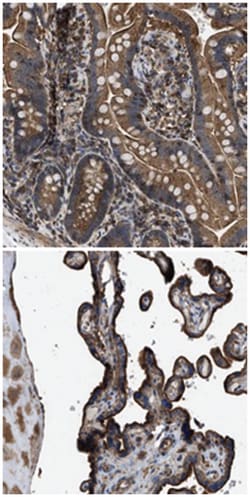 LINGO2, Rabbit, Polyclonal Antibody, Abnova 100&mu;L; Unlabeled:Antibodies,