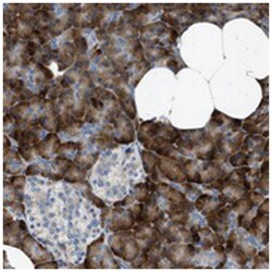 CNTN6, Rabbit, Polyclonal Antibody, Abnova 100&mu;L; Unlabeled:Antibodies,