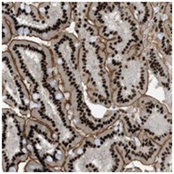 ZFR, Rabbit, Polyclonal Antibody, Abnova 100 &mu;L | Buy Online | Abnova Corporation | Fisher Scientific