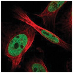 ZFR, Rabbit, Polyclonal Antibody, Abnova 100 &mu;L | Buy Online | Abnova Corporation | Fisher Scientific