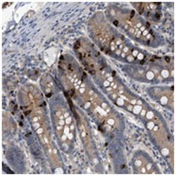 CTXN1, Rabbit, Polyclonal Antibody, Abnova 100 &mu;L | Buy Online | Abnova Corporation | Fisher Scientific