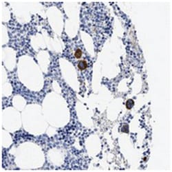 TREML1 Rabbit anti-Human, Polyclonal Antibody, Abnova 100 &mu;L | Buy Online | Abnova Corporation | Fisher Scientific