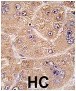 FUCA2, Rabbit, Polyclonal Antibody, Abnova 400 &mu;L | Buy Online | Abnova Corporation | Fisher Scientific