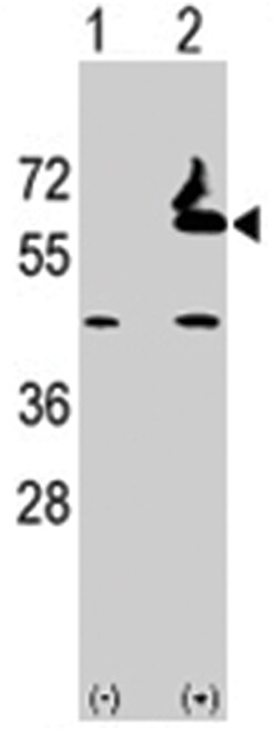 FUCA2, Rabbit, Polyclonal Antibody, Abnova 400 &mu;L | Buy Online | Abnova Corporation | Fisher Scientific