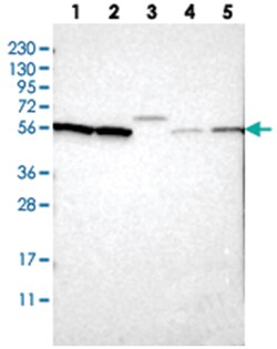 SLC15A4, Rabbit, Polyclonal Antibody, Abnova 100 &mu;L | Buy Online | Abnova Corporation | Fisher Scientific