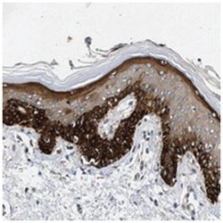 RAPH1 Rabbit anti-Human, Polyclonal Antibody, Abnova 100 &mu;L | Buy Online | Abnova Corporation | Fisher Scientific