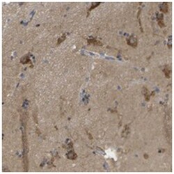 ZDHHC17, Rabbit, Polyclonal Antibody, Abnova 100&mu;L; Unlabeled:Antibodies,