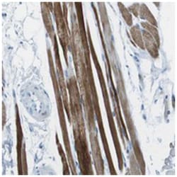 SLC16A10, Rabbit, Polyclonal Antibody, Abnova 100 &mu;L | Buy Online | Abnova | Fisher Scientific