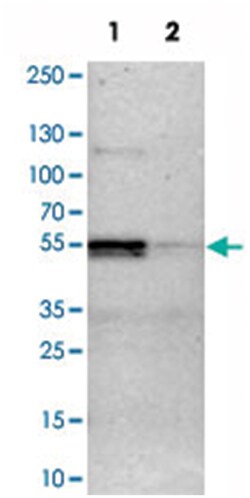 HNRNPH2 Rabbit anti-Human, Mouse, Rat, Polyclonal Antibody, Abnova 100&mu;L;