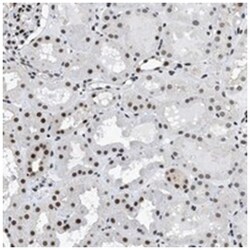 HNRNPH2 Rabbit anti-Human, Mouse, Rat, Polyclonal Antibody, Abnova 100&mu;L;