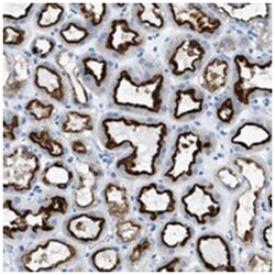 C21orf62, Rabbit, Polyclonal Antibody, Abnova 100 &mu;L | Buy Online | Abnova Corporation | Fisher Scientific