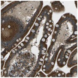 USP30, Rabbit, Polyclonal Antibody, Abnova 100 &mu;L | Buy Online | Abnova Corporation | Fisher Scientific