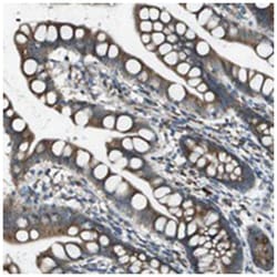UTS2 Rabbit anti-Human, Polyclonal Antibody, Abnova 100 &mu;L | Buy Online | Abnova Corporation | Fisher Scientific