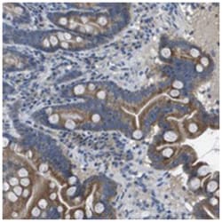CLCA4, Rabbit, Polyclonal Antibody, Abnova 100 &mu;L | Buy Online | Abnova Corporation | Fisher Scientific