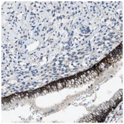 PTGFRN, Rabbit, Polyclonal Antibody, Abnova 100 &mu;L | Buy Online | Abnova Corporation | Fisher Scientific
