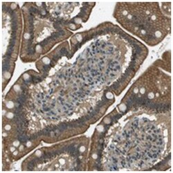 SDC3 Rabbit anti-Human, Polyclonal Antibody, Abnova 100&mu;L; Unlabeled:Antibodies,