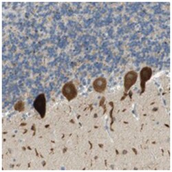 PLBD2, Rabbit, Polyclonal Antibody, Abnova 100 &mu;L | Buy Online | Abnova Corporation | Fisher Scientific