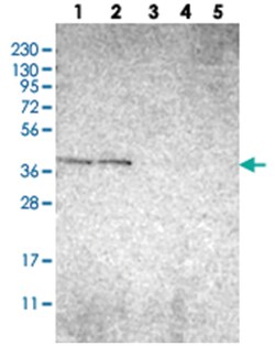 C6orf72, Rabbit, Polyclonal Antibody, Abnova 100&mu;L; Unlabeled:Antibodies,