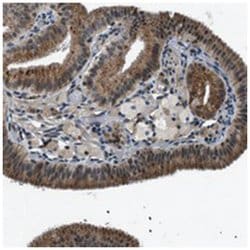 C6orf72, Rabbit, Polyclonal Antibody, Abnova 100&mu;L; Unlabeled:Antibodies,