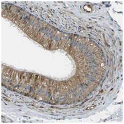 LRP12, Rabbit, Polyclonal Antibody, Abnova 100&mu;L; Unlabeled:Antibodies,