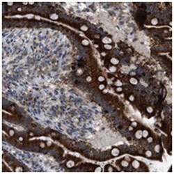 FAM69A Rabbit anti-Human, Polyclonal Antibody, Abnova 100 &mu;L | Buy Online | Abnova Corporation | Fisher Scientific
