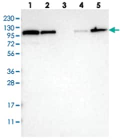 STRN Rabbit anti-Human, Mouse, Rat, Polyclonal Antibody, Abnova 100 &mu;L | Buy Online | Abnova Corporation | Fisher Scientific